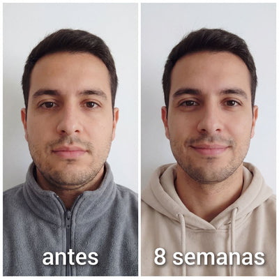 Banda Moldeadora de Colágeno CaraDura