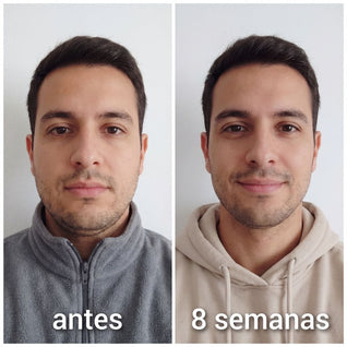 Banda Moldeadora de Colágeno CaraDura