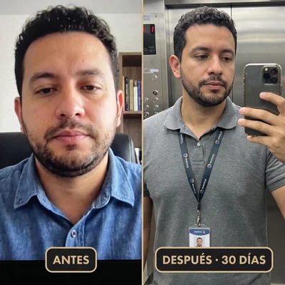 DESHINCHA™ | Gotas de Drenaje Linfático